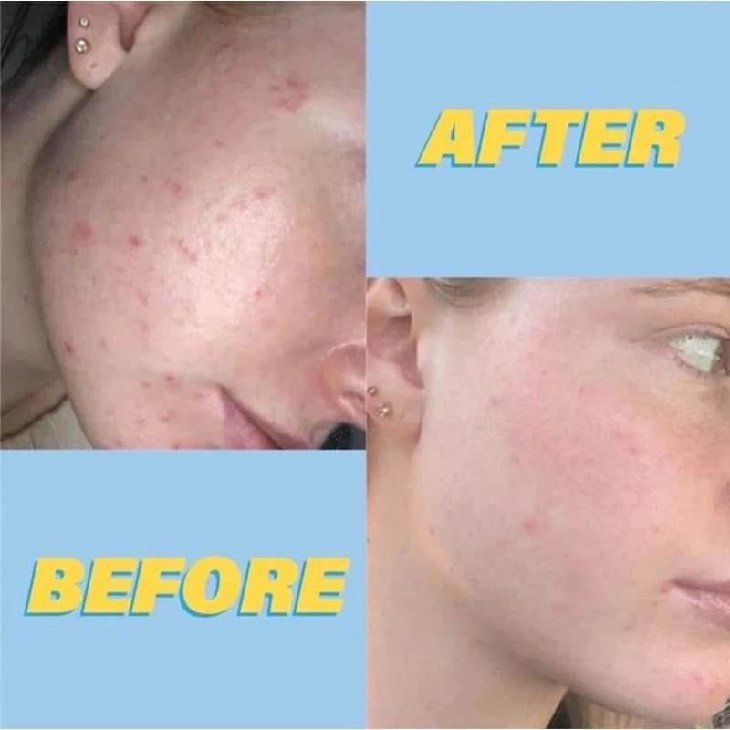 vn-11134207-7ras8-mb2pd2kn7kd332