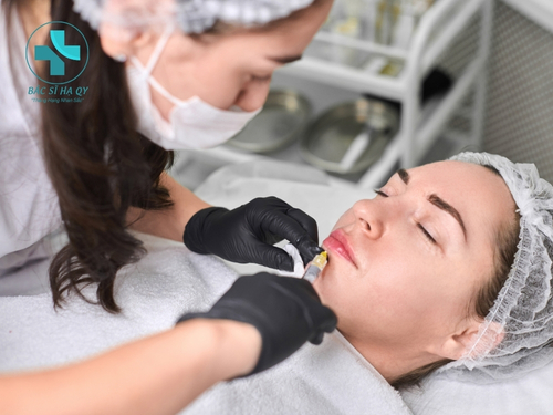 Bác sĩ tư vấn cho người bệnh về giá tiêm filler và một số vấn đề liên quan