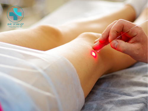 Đốt Laser Có Đau Không? Cảm Giác Thật & Cách Giảm Đau Hiệu Quả 1